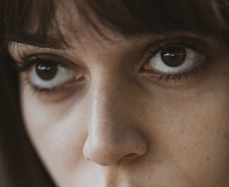 Dark Circles