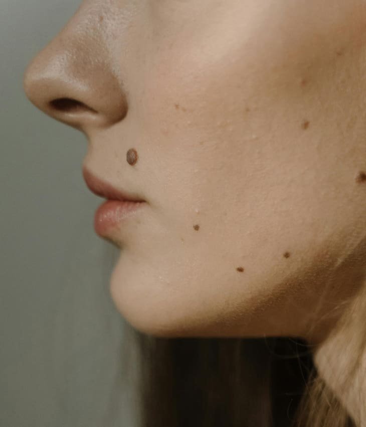 3. Refinement:
