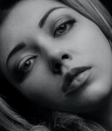 Lip Filler