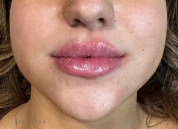 Lips