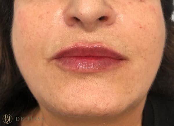 Lips
