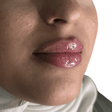 Lips