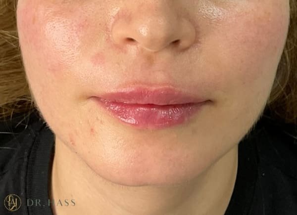 Lips