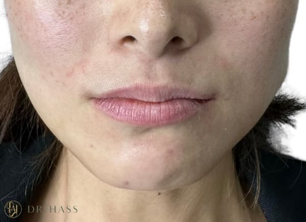 Lips