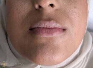 Lips