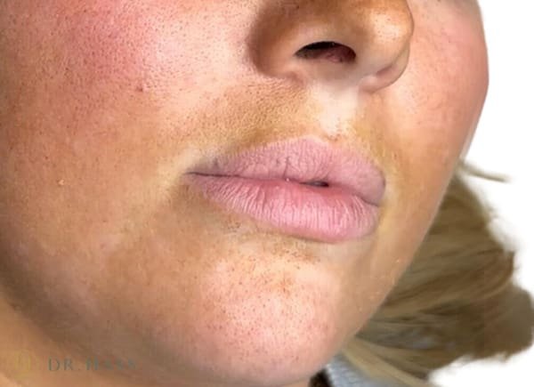 Lips