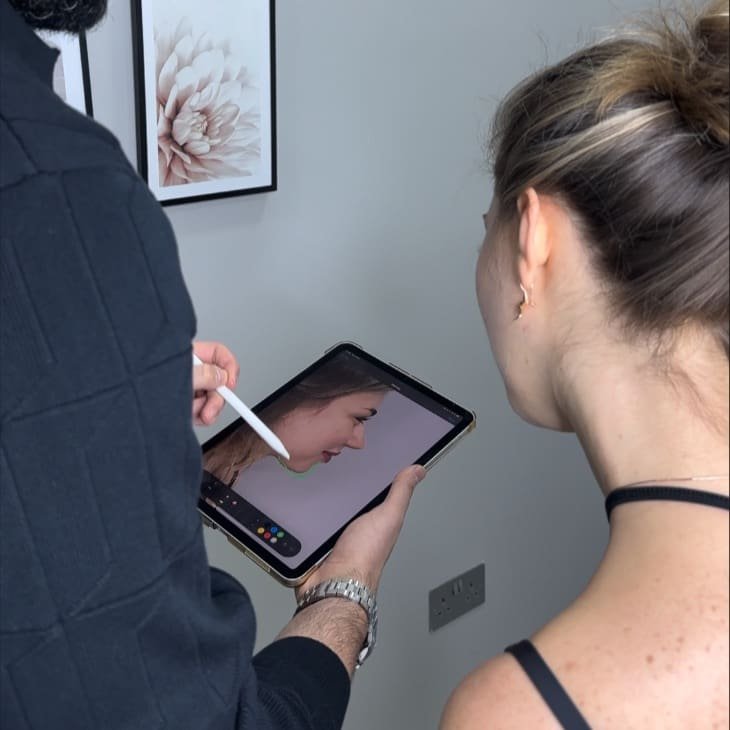 Chin Filler London - Precise Chin Augmentation Planning