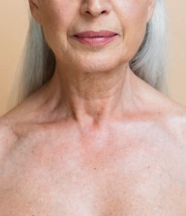 Wrinkly Chest: Causes, Prevention and Treatments