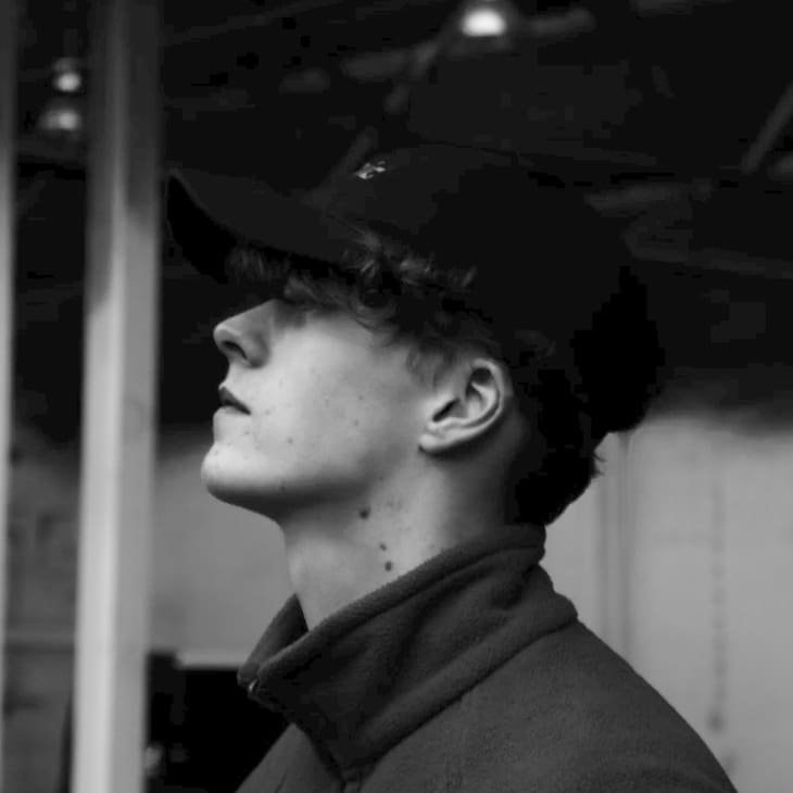 jawline filler