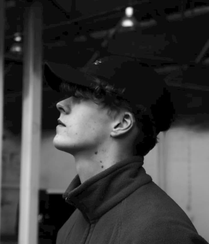 jawline filler