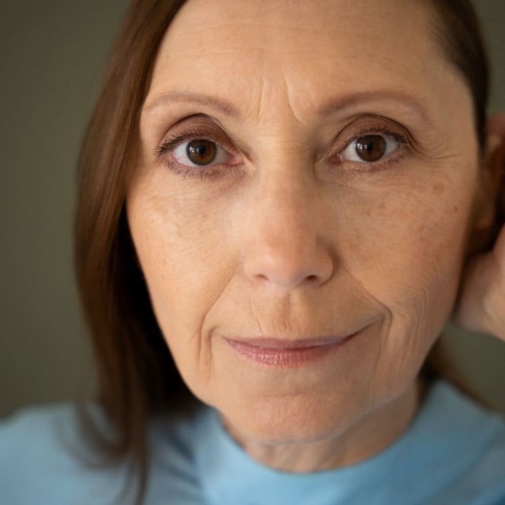 age-spots-woman