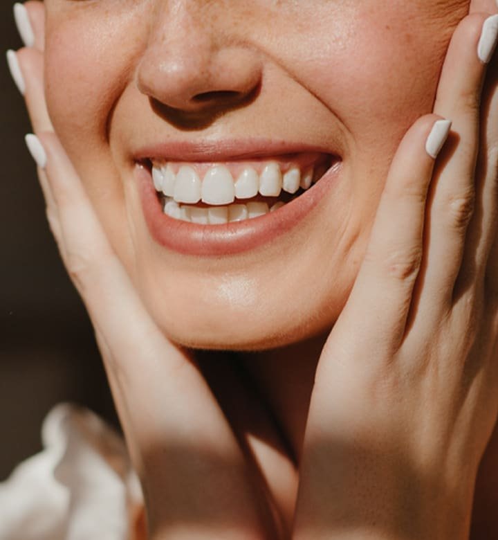 Gummy Smile