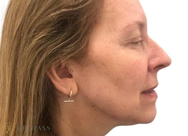 Dr Hass - Profile Balancing
