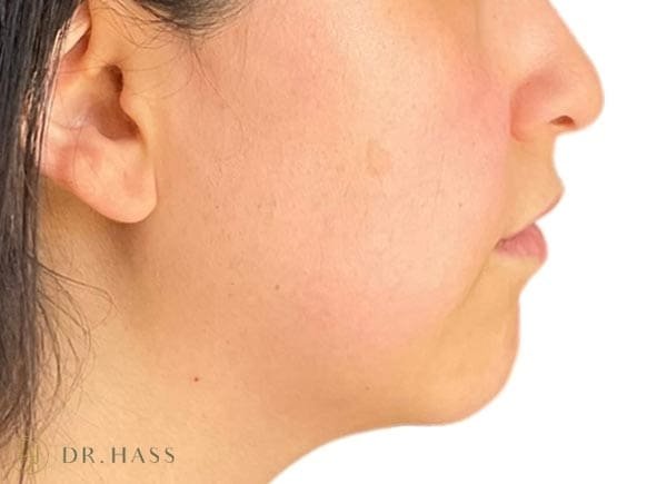 Dr Hass - Profile Balancing