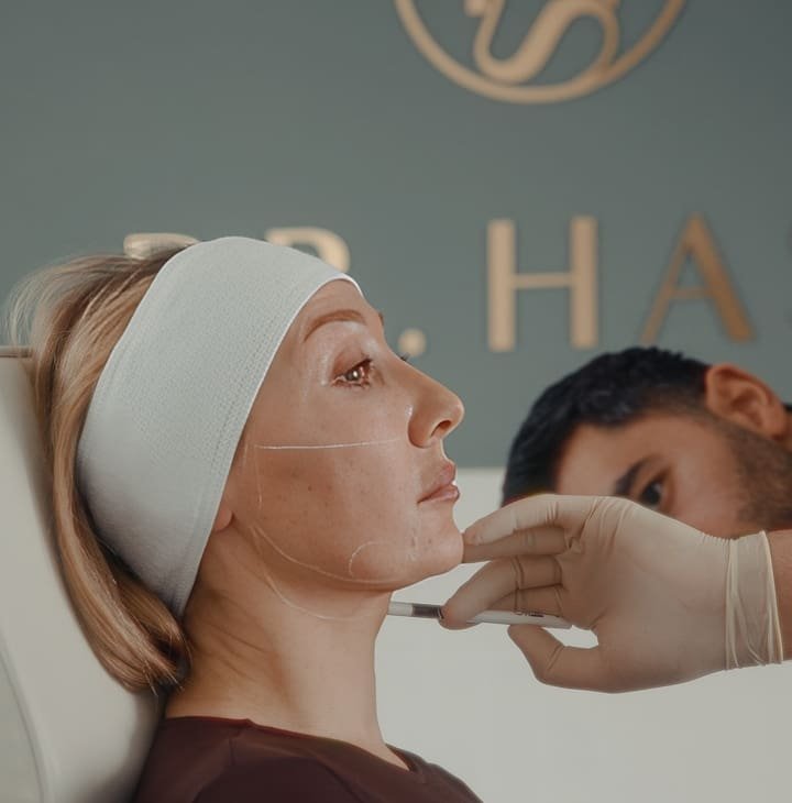 Full Face Rejuvenation London - Precision mapping