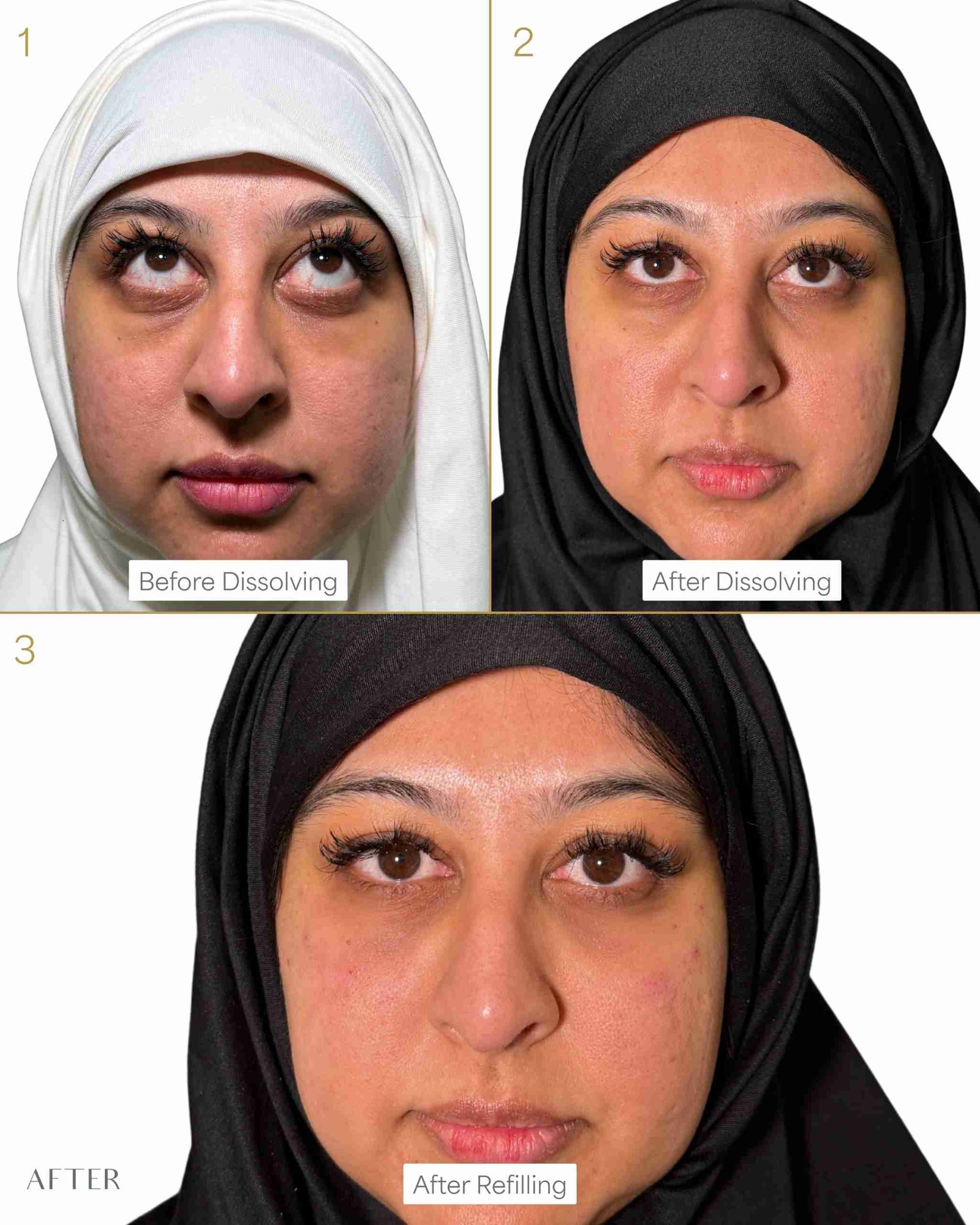 2. Preparation & Treatment: