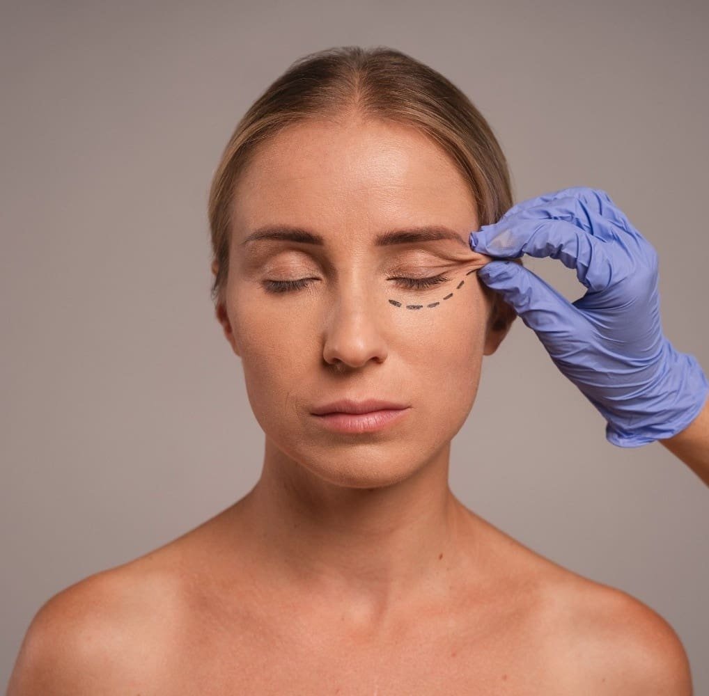 2. Preparation & Treatment: